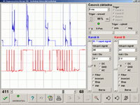 CKP sensor fault