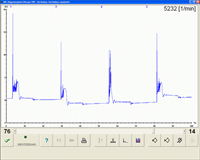 Ignition waveform
