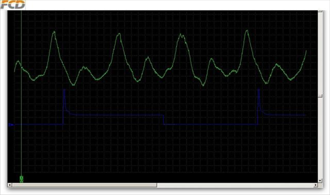 MAP, injector 1, revs cca 2500.