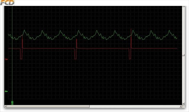 MAP, injector 1, idle